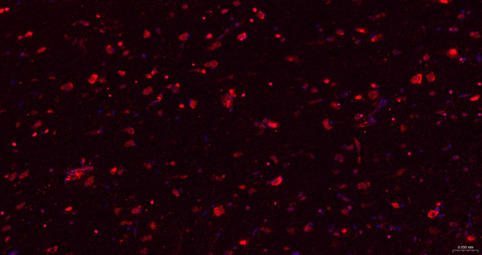 糖原合酶激酶-3β重组兔单抗-bsm-63070R