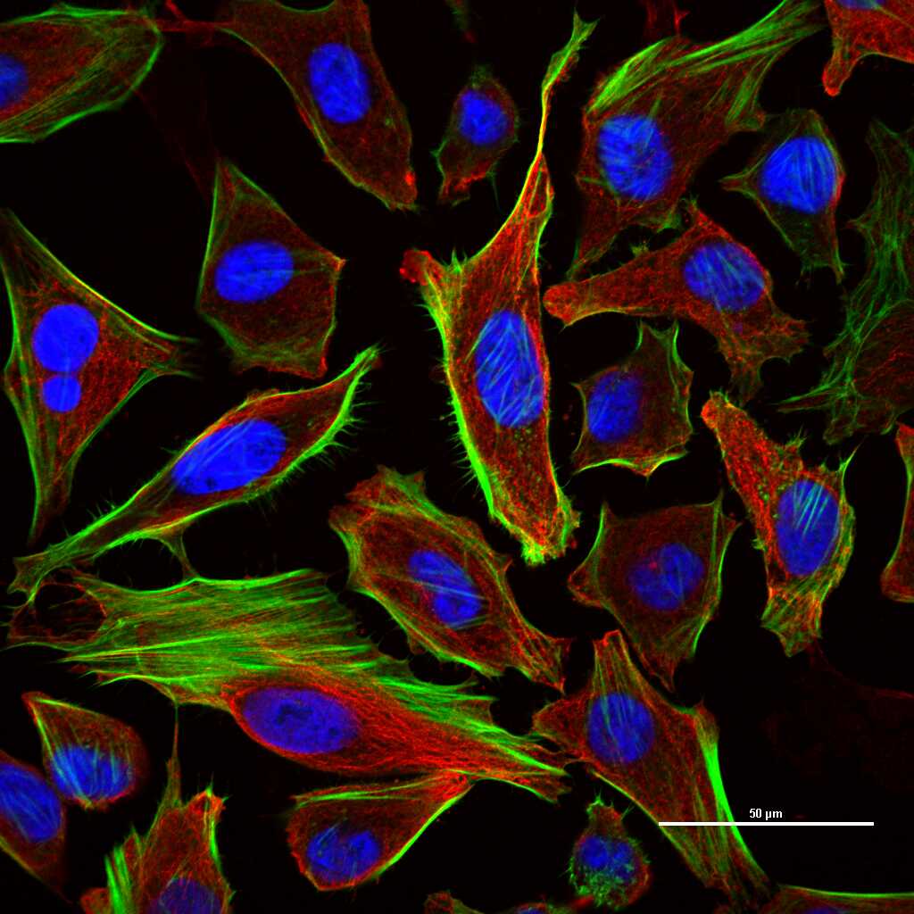 微管蛋白β tubulin/Tubulin β（内参）重组兔单抗-bsm-33034R