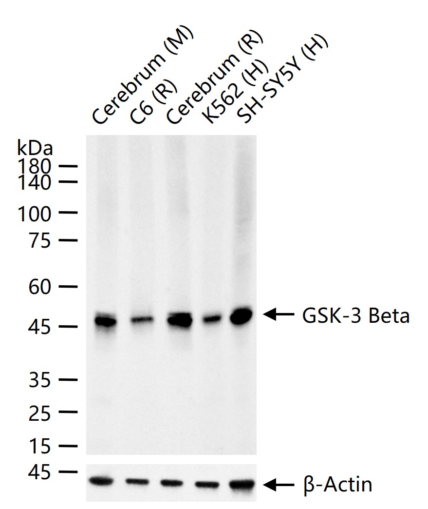 糖原合酶激酶-3β重组兔单抗-bsm-63070R