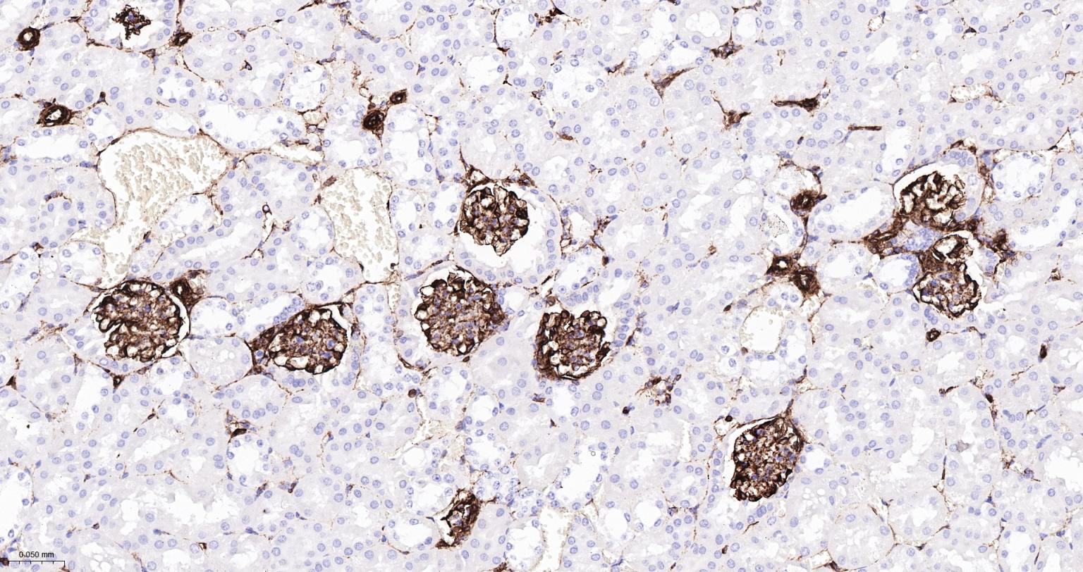 波形蛋白重组兔单抗-bsm-63101R