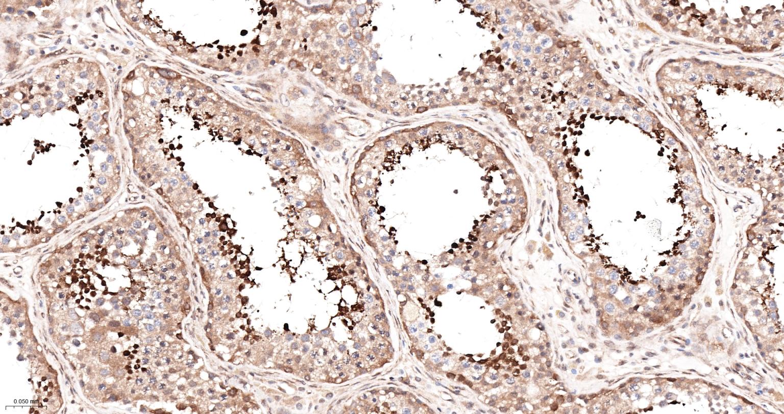 糖原合酶激酶-3β重组兔单抗-bsm-63070R