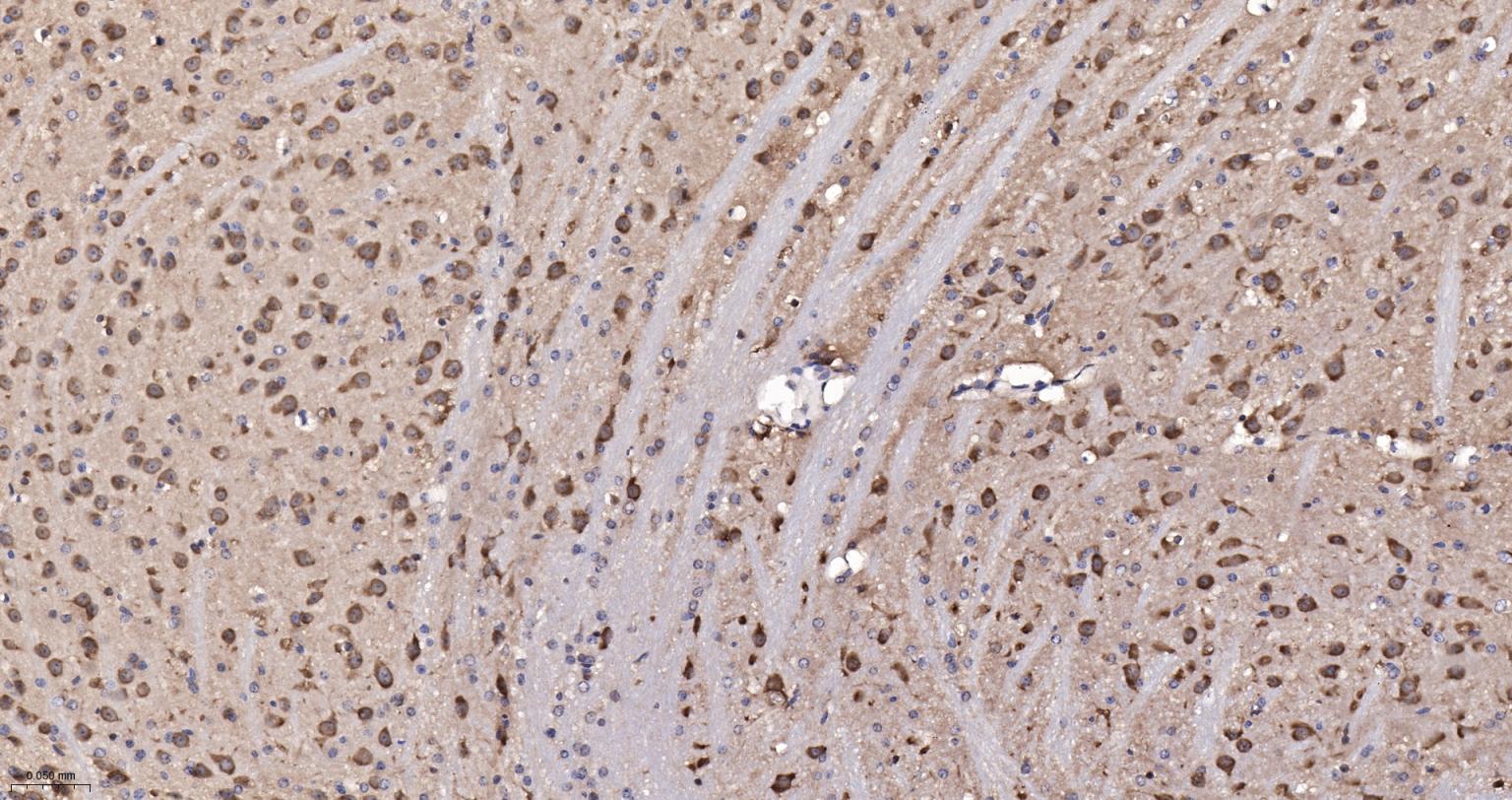 糖原合酶激酶-3β重组兔单抗-bsm-63070R