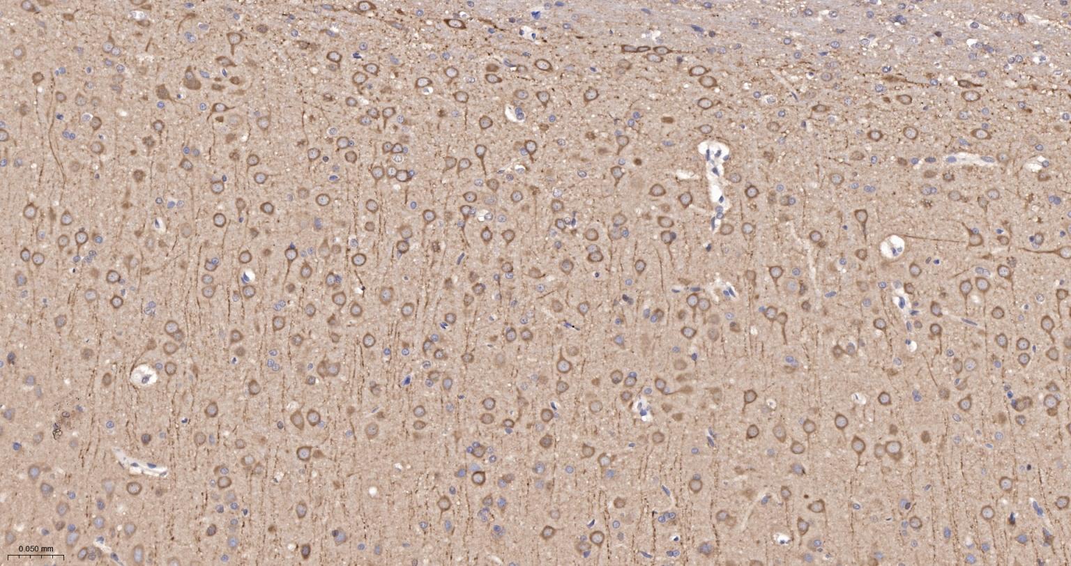 糖原合酶激酶-3β重组兔单抗-bsm-63070R