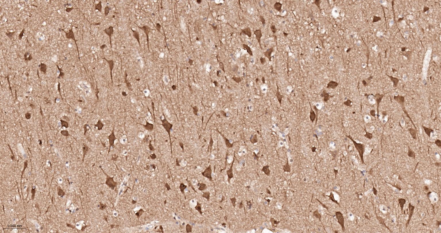 糖原合酶激酶-3β重组兔单抗-bsm-63070R