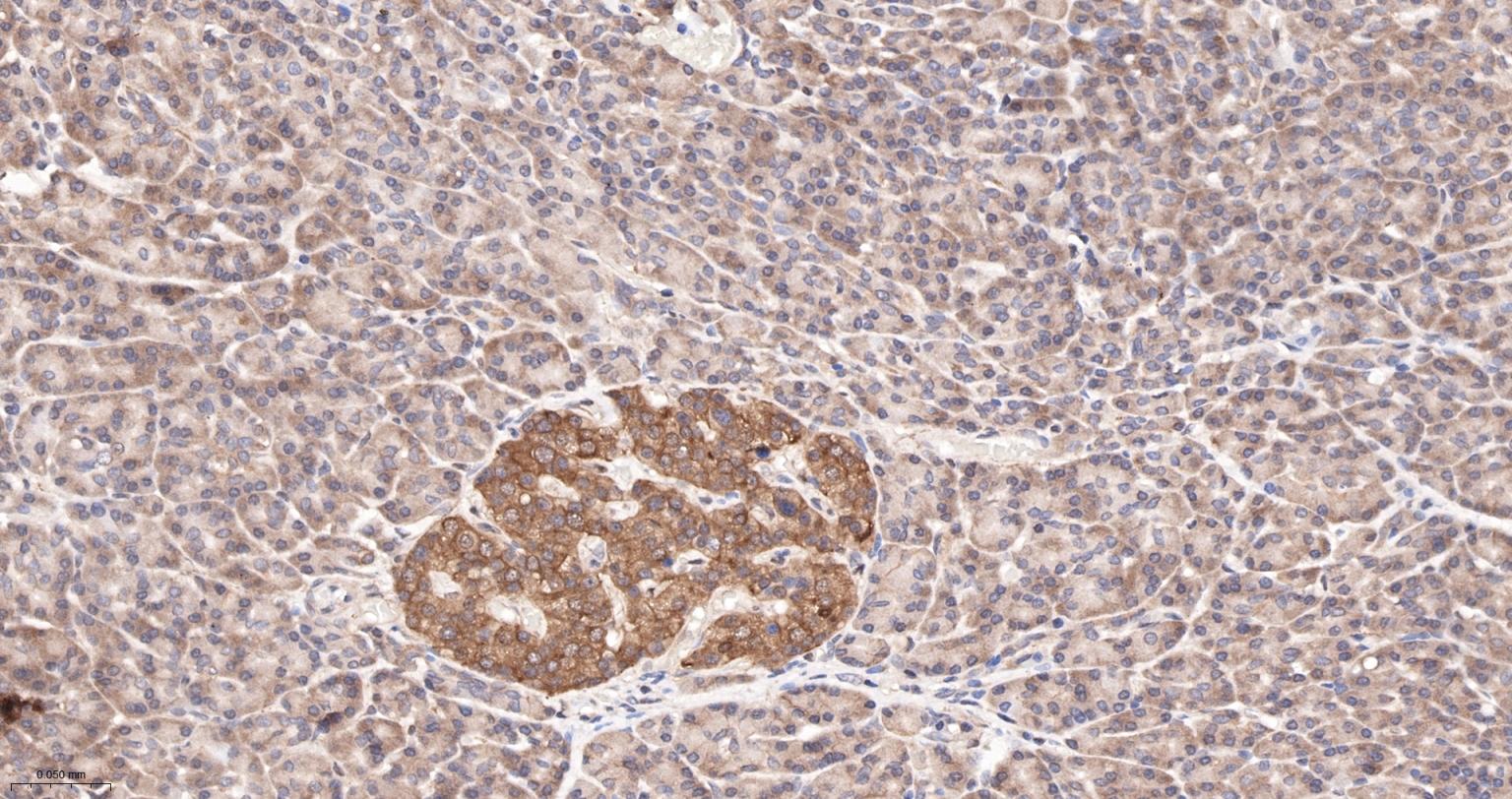 糖原合酶激酶-3β重组兔单抗-bsm-63070R