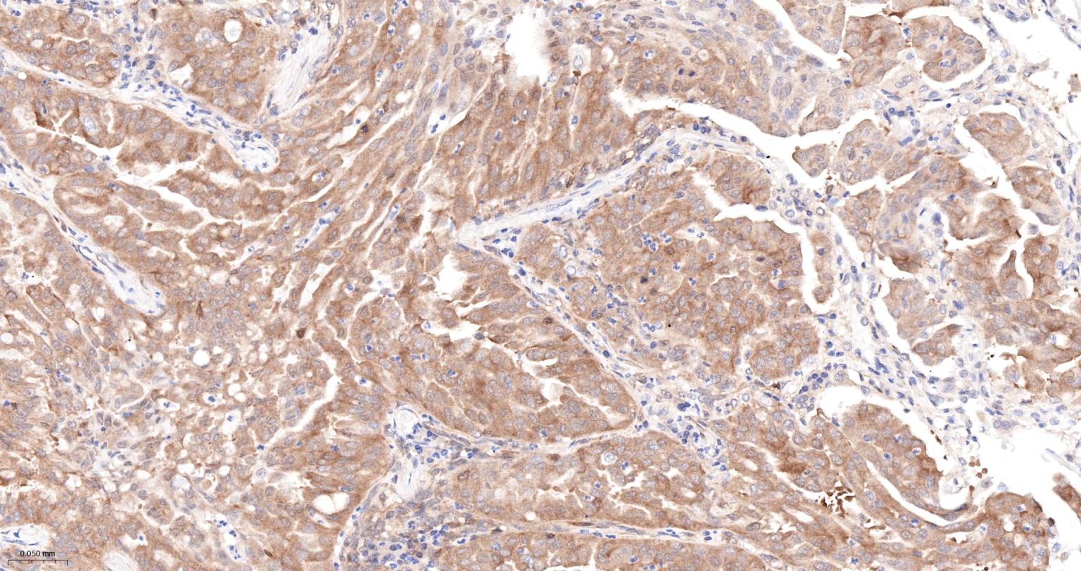 糖原合酶激酶-3β重组兔单抗-bsm-63070R