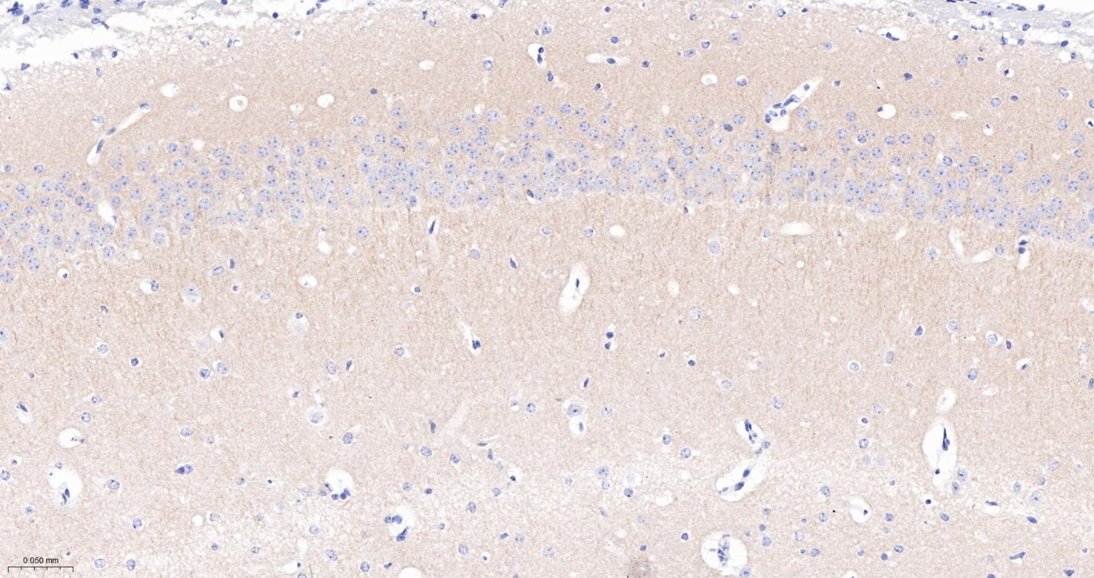 突触后密度蛋白95重组兔单抗-bsm-55665R