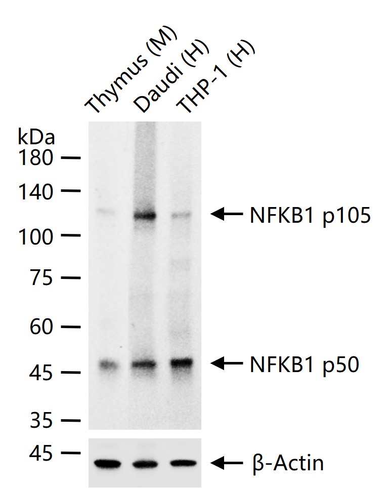 细胞核因子p105/p50/k基因结合核因子重组兔单抗-bsm-52309R