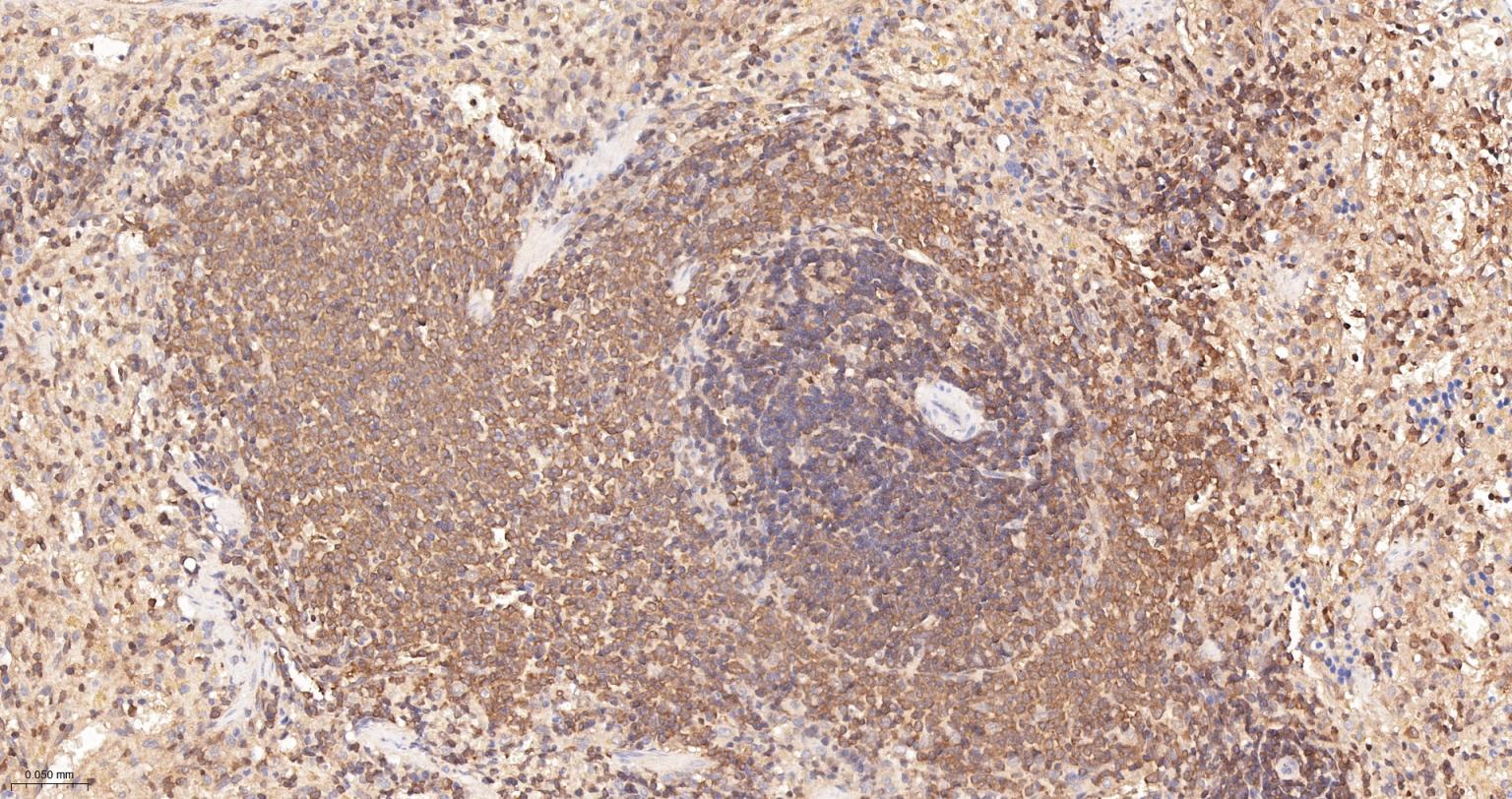 细胞核因子p105/p50/k基因结合核因子重组兔单抗-bsm-52309R