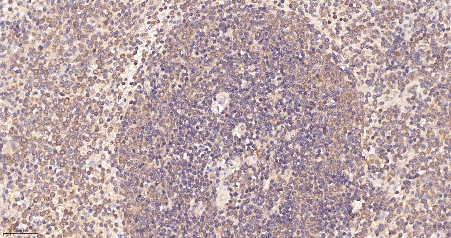 细胞核因子p105/p50/k基因结合核因子重组兔单抗-bsm-52309R