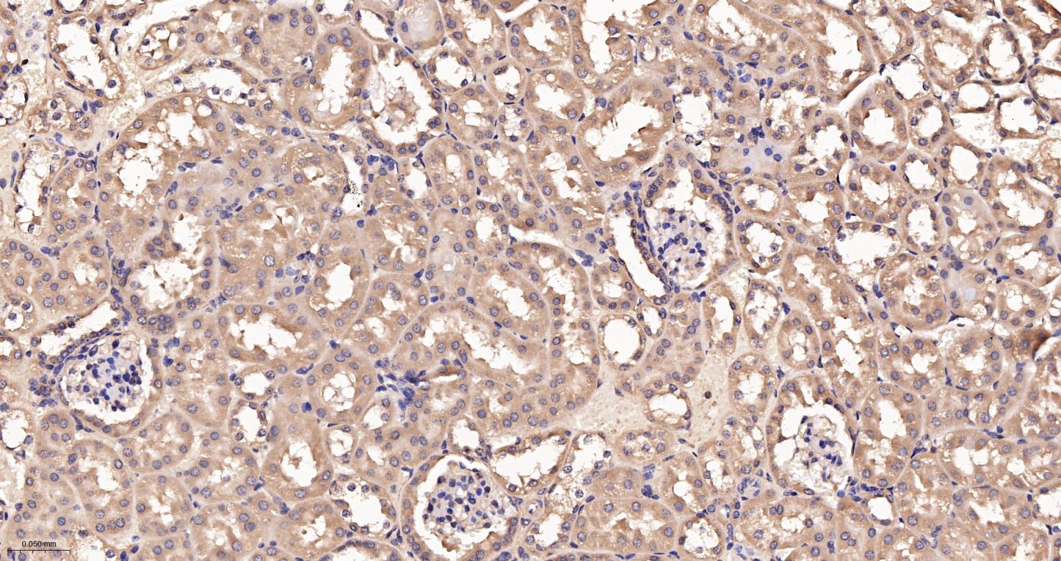 细胞核因子p105/p50/k基因结合核因子重组兔单抗-bsm-52309R