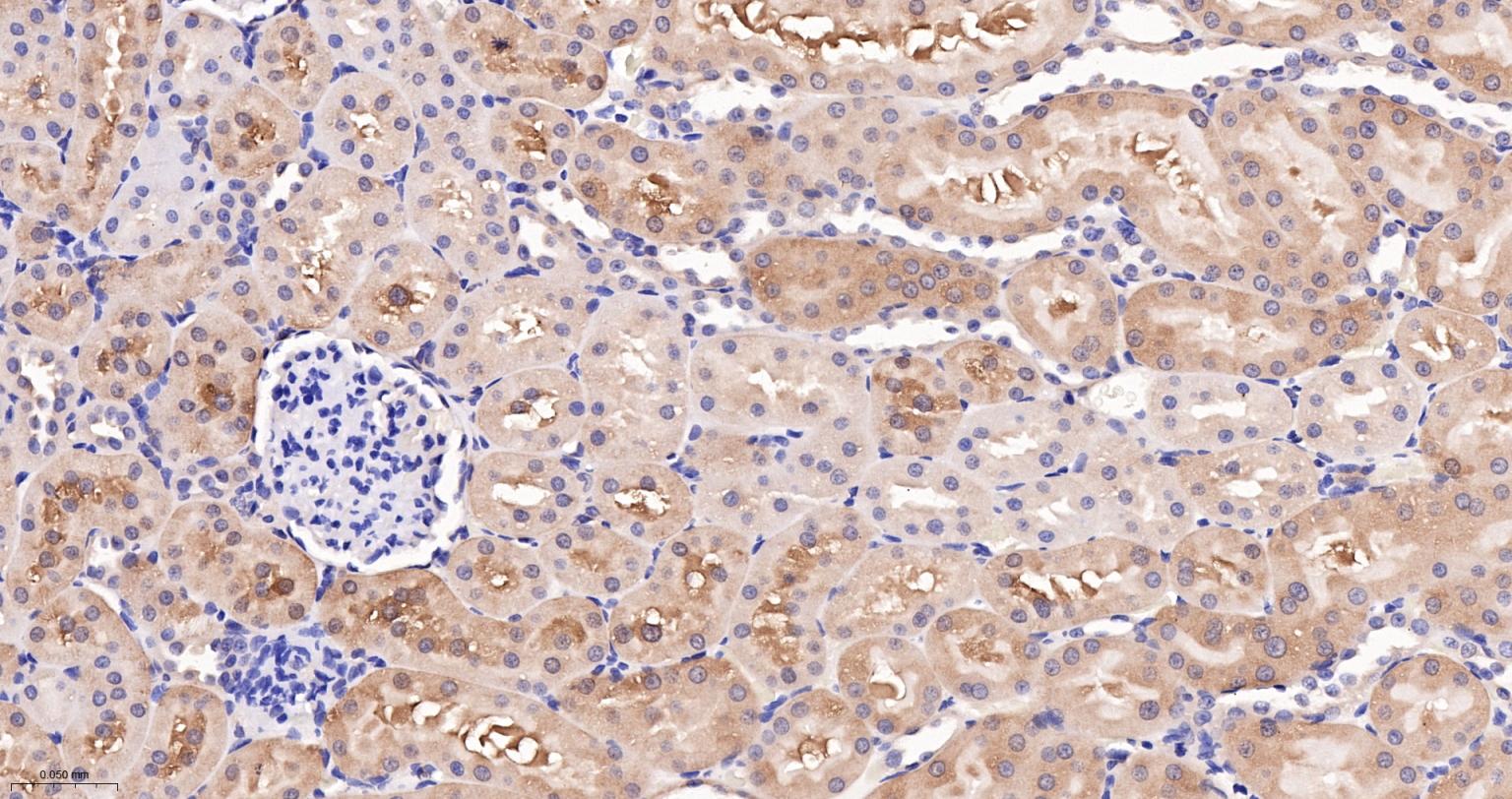 细胞核因子p105/p50/k基因结合核因子重组兔单抗-bsm-52309R