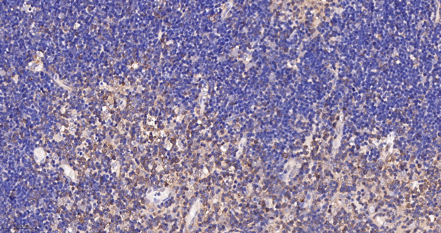 细胞核因子p105/p50/k基因结合核因子重组兔单抗-bsm-52309R