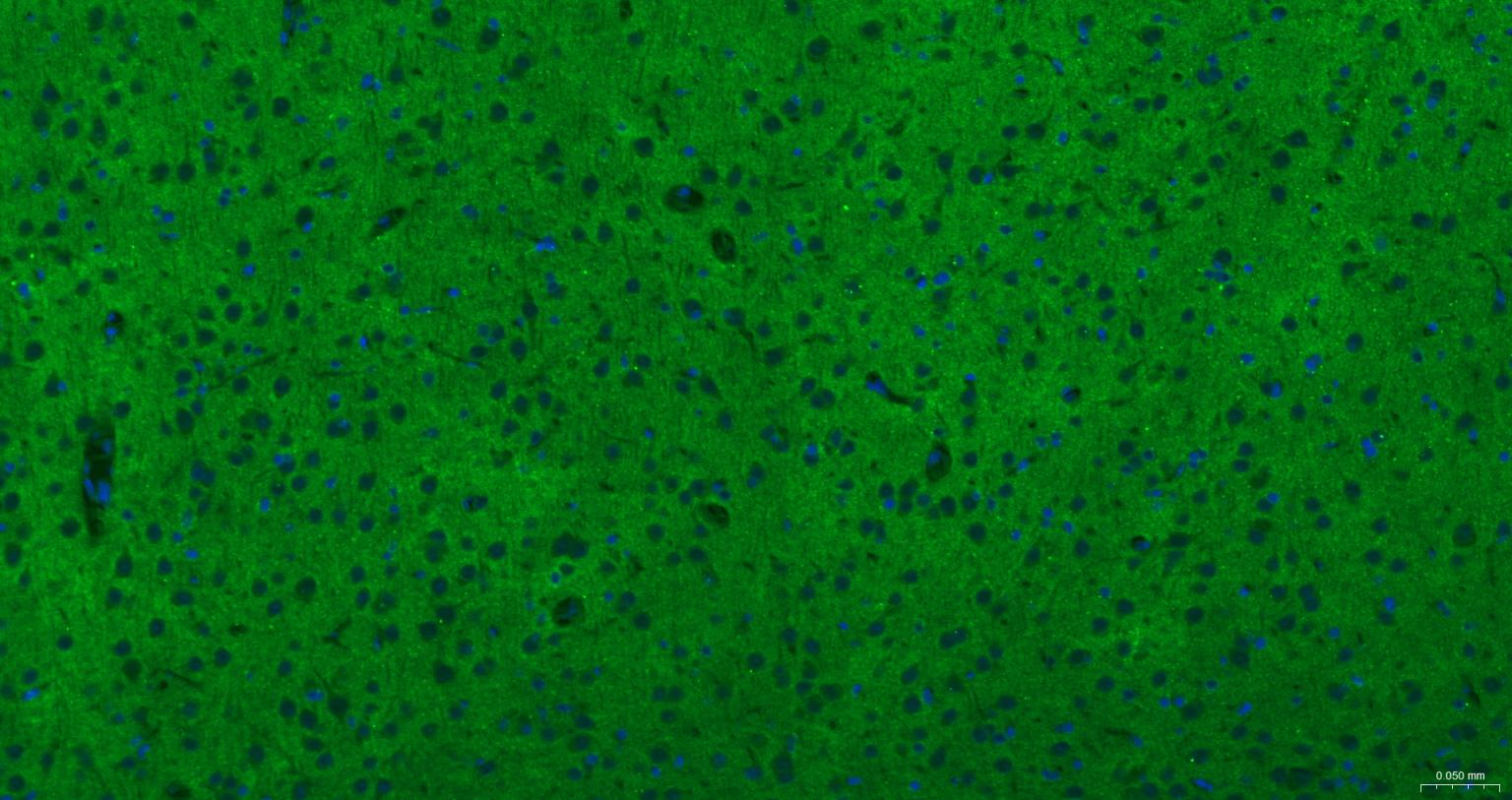 酪氨酸激酶B重组兔单抗-bsm-61083R