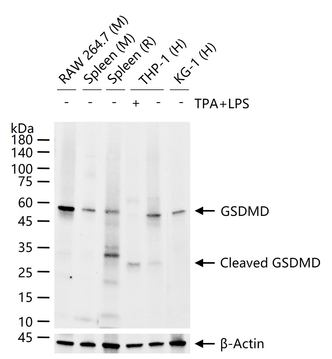 Gasdermin D蛋白重组兔单抗-bsm-55614R