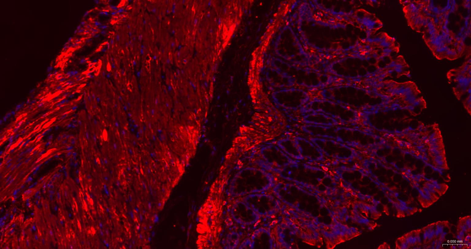 肌动蛋白α/α-SMA/α Actin抗体-bs-10196R