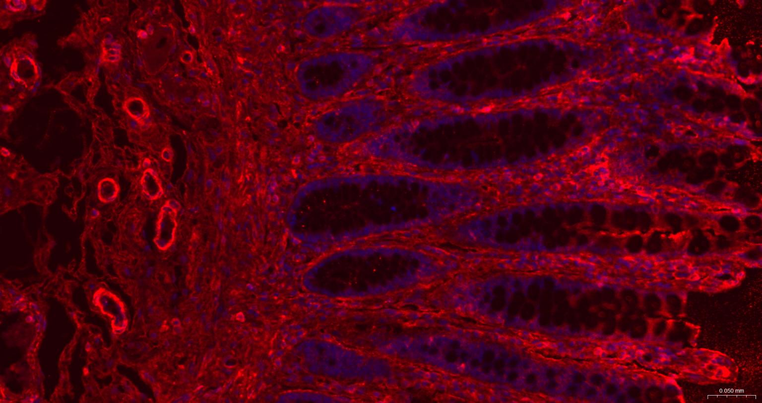 肌动蛋白α/α-SMA/α Actin抗体-bs-10196R