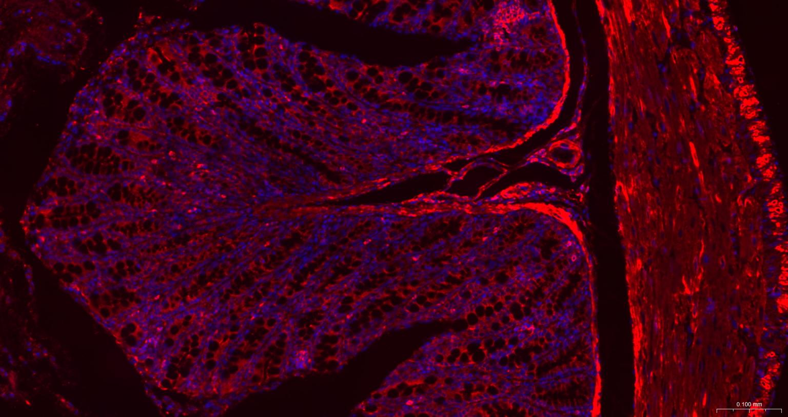 肌动蛋白α/α-SMA/α Actin抗体-bs-10196R