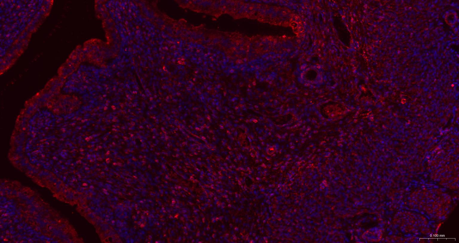 肌动蛋白α/α-SMA/α Actin抗体-bs-10196R