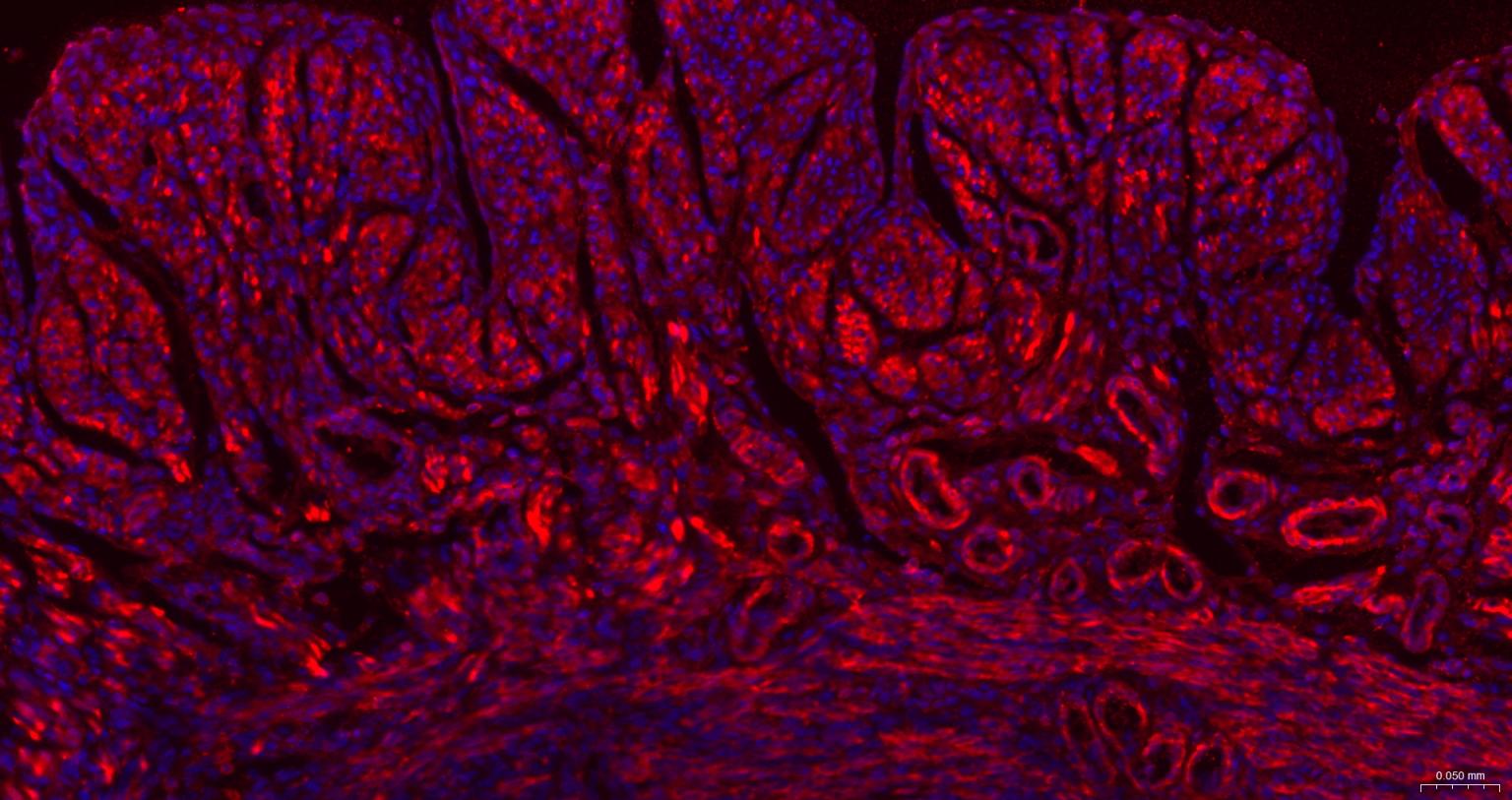 肌动蛋白α/α-SMA/α Actin抗体-bs-10196R