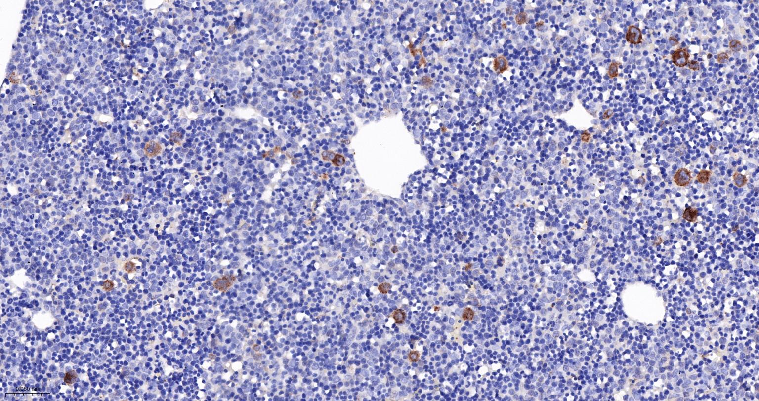 转化生长因子β1重组兔单抗-bsm-61027R