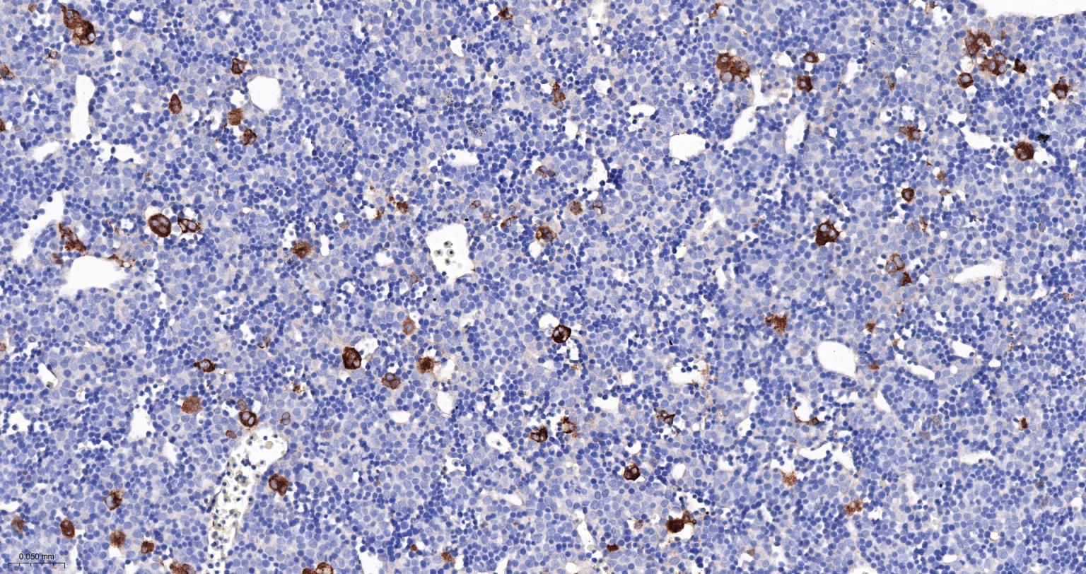 转化生长因子β1重组兔单抗-bsm-61027R