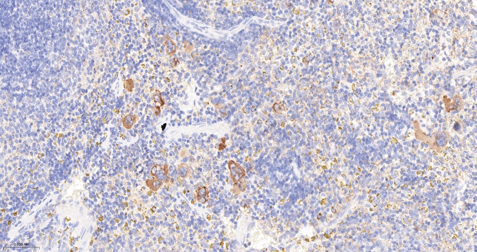 转化生长因子β1重组兔单抗-bsm-61027R