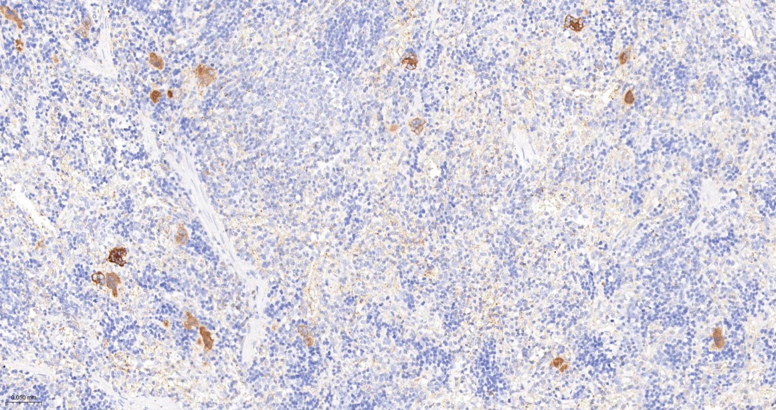 转化生长因子β1重组兔单抗-bsm-61027R