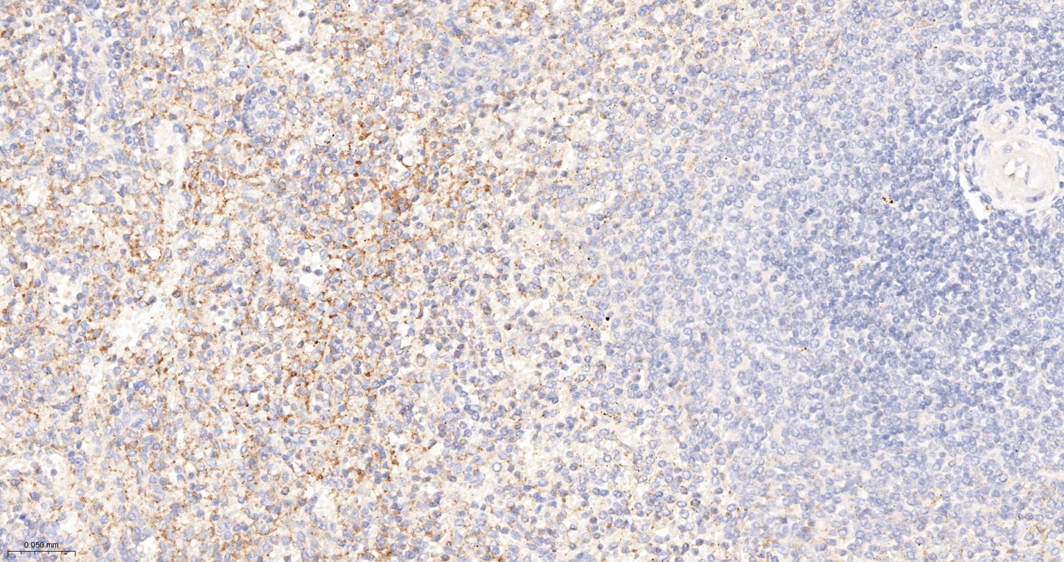 转化生长因子β1重组兔单抗-bsm-61027R
