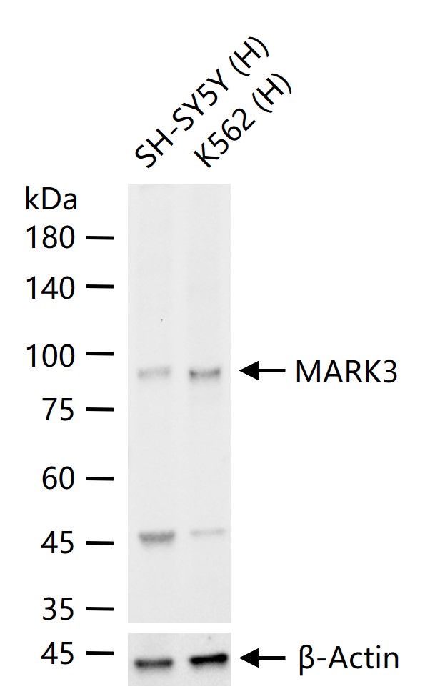 兔抗磷酸化丝氨酸/苏氨酸蛋白激酶MARK3单克隆抗体-bsm-54462R