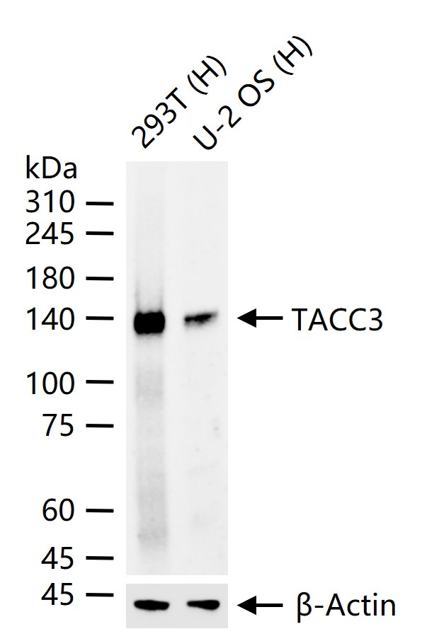 TACC3重组兔单抗-bsm-61119R