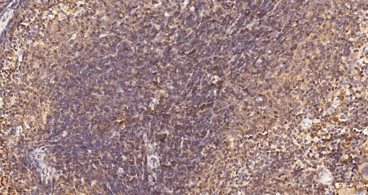 信号转导和转录激活因子6重组兔单抗-bsm-52239R