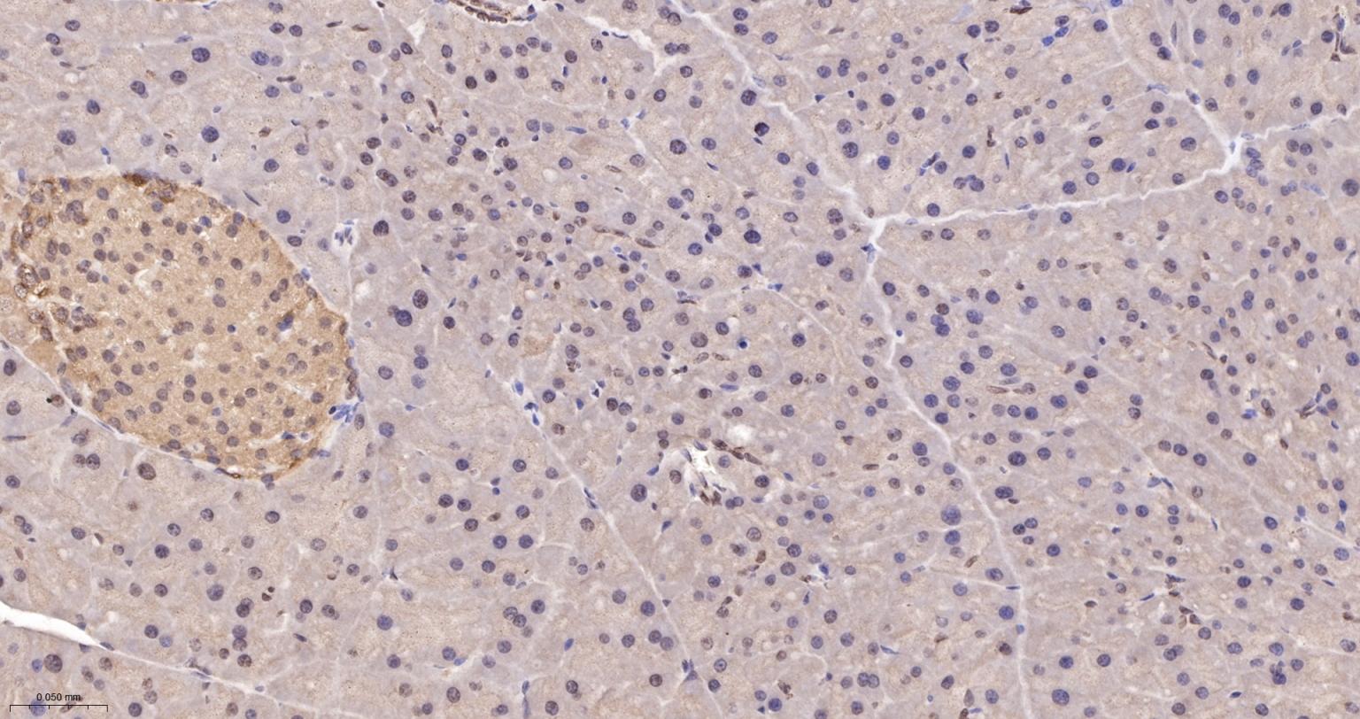 细胞核转录因子X盒结合蛋白重组兔单抗-bsm-61423R