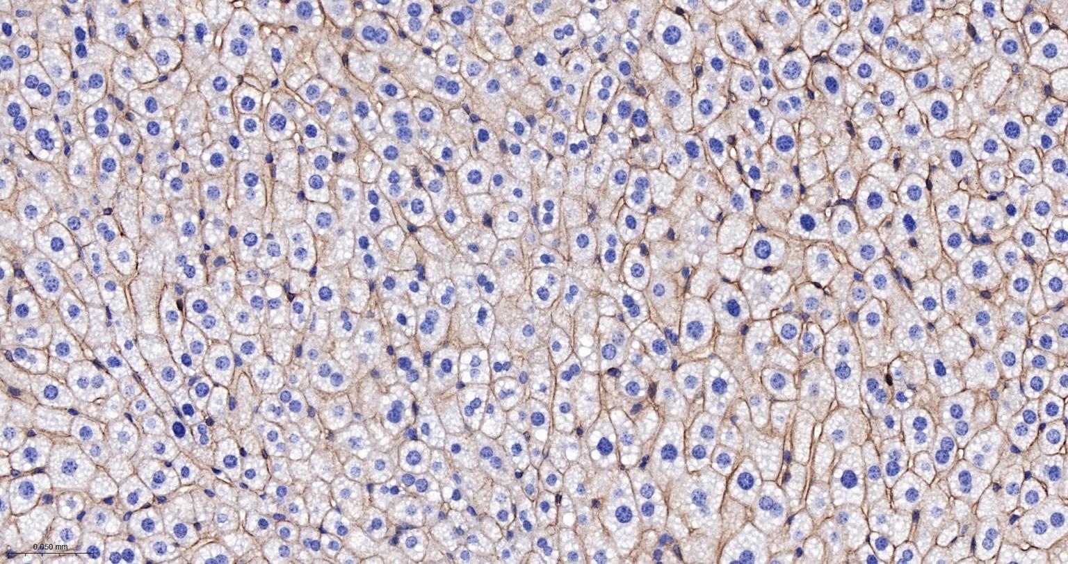上皮钙粘附分子重组兔单抗-bsm-63043R