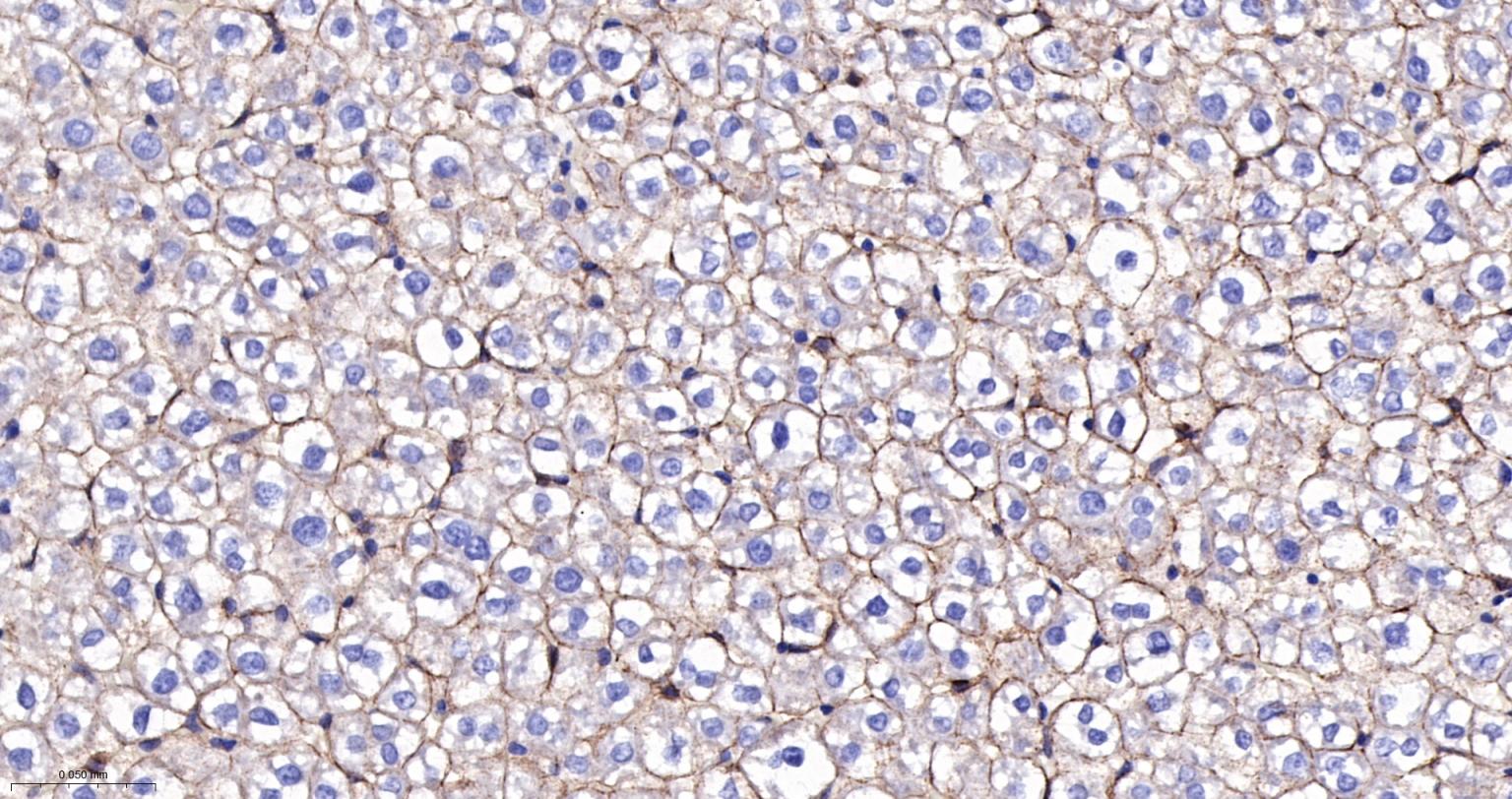 上皮钙粘附分子重组兔单抗-bsm-63043R