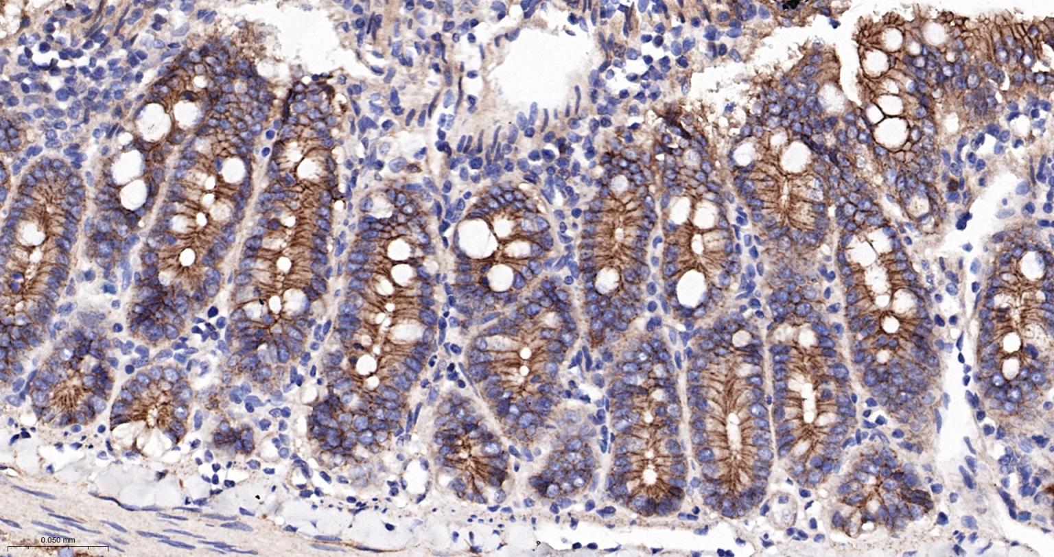 上皮钙粘附分子重组兔单抗-bsm-63043R
