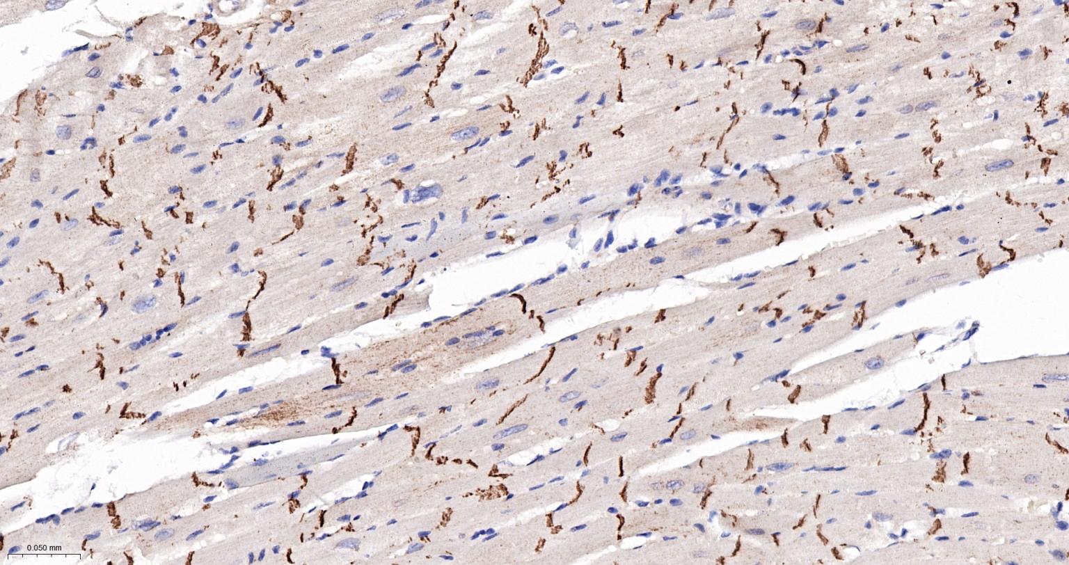 上皮钙粘附分子重组兔单抗-bsm-63043R