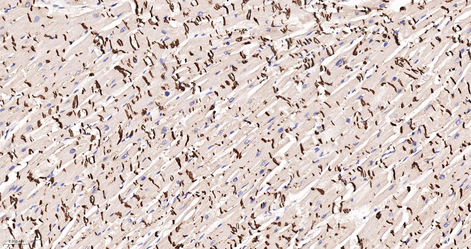 上皮钙粘附分子重组兔单抗-bsm-63043R