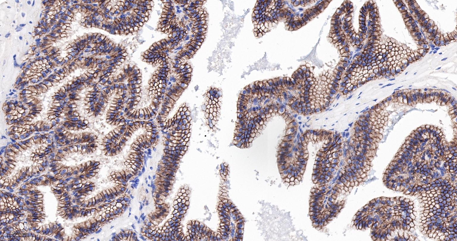 上皮钙粘附分子重组兔单抗-bsm-63043R