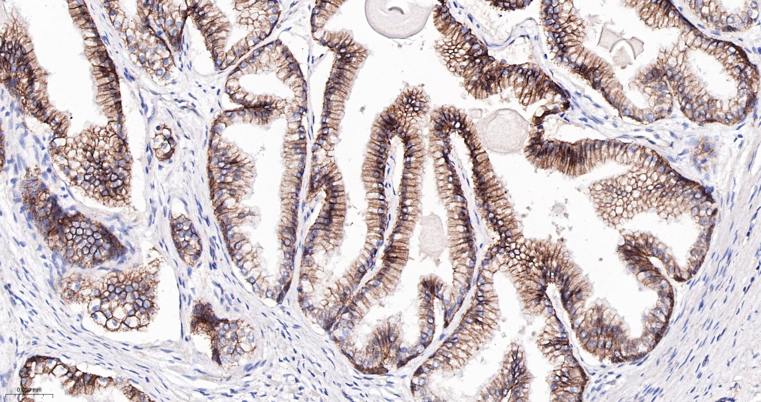 上皮钙粘附分子重组兔单抗-bsm-63043R