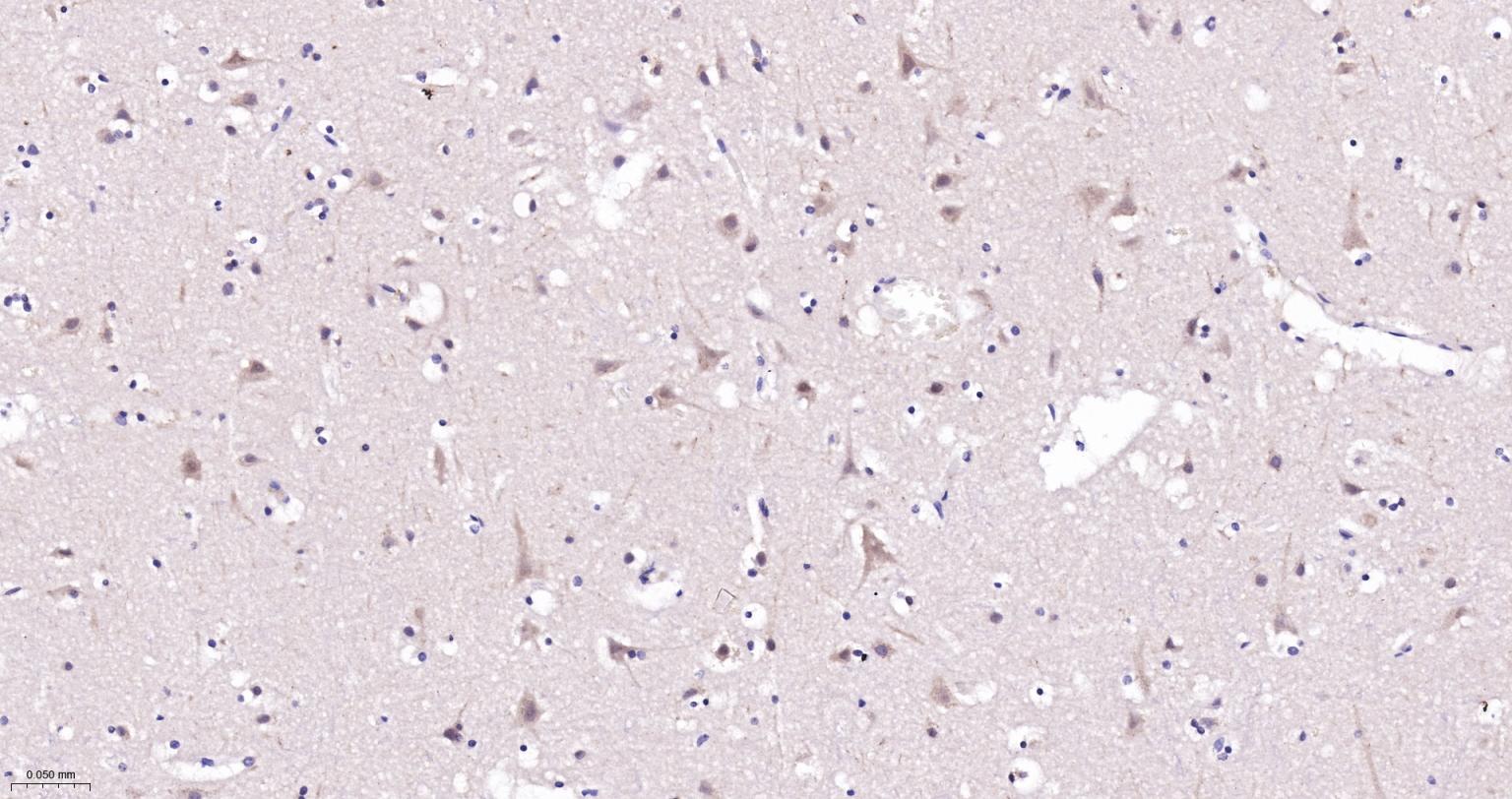 胞质接头蛋白Keap1重组兔抗体-bsm-60935R