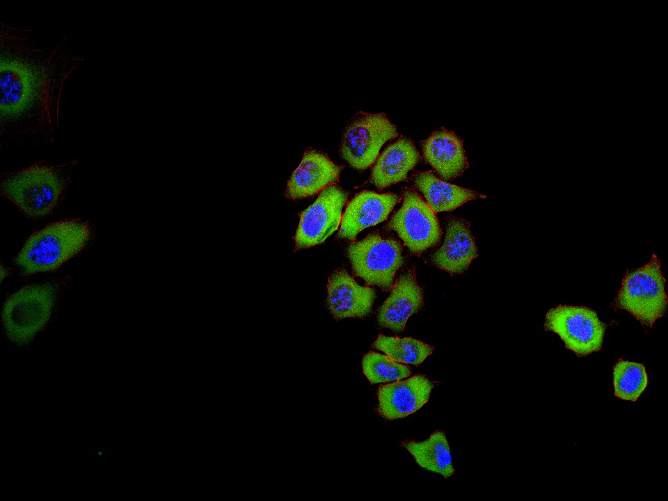 热休克蛋白90β/HSP90 β 重组兔单抗-bsm-61128R