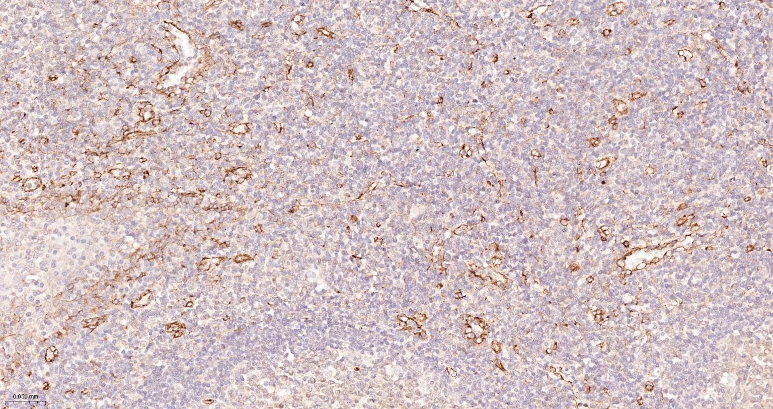 干扰素诱导跨膜蛋白3重组兔单抗-bsm-63221R