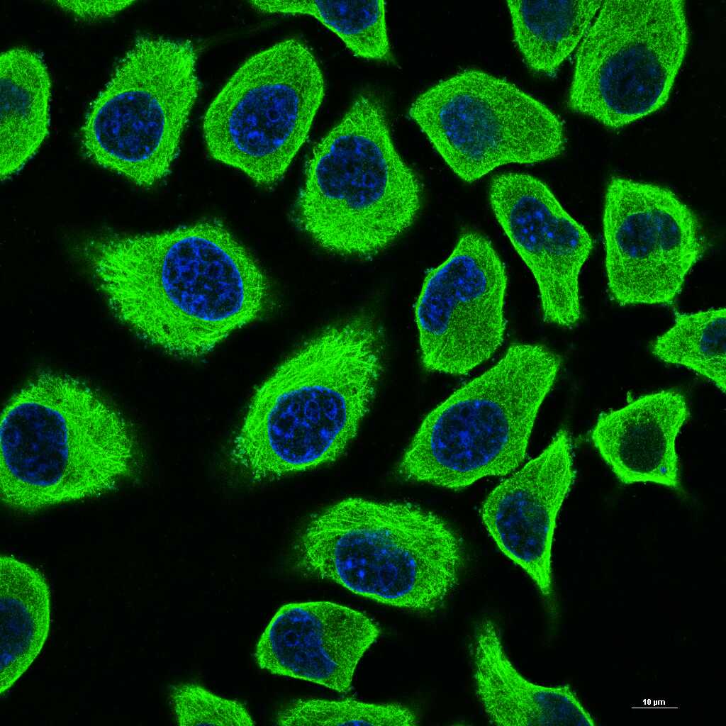 微管蛋白α/Tubulin α/α-tubulin单克隆抗体-bsm-33039M