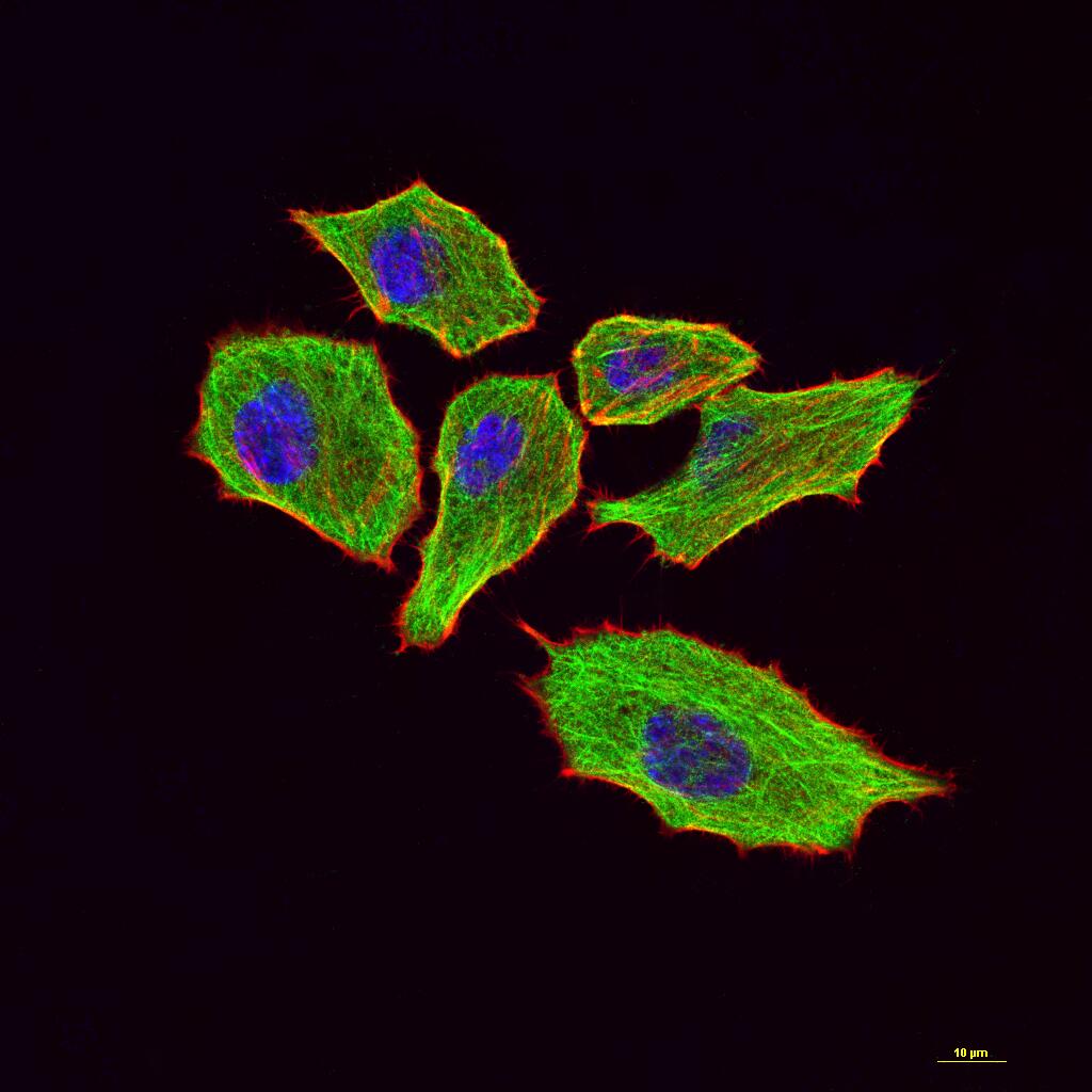 微管蛋白α/Tubulin α/α-tubulin单克隆抗体-bsm-33039M