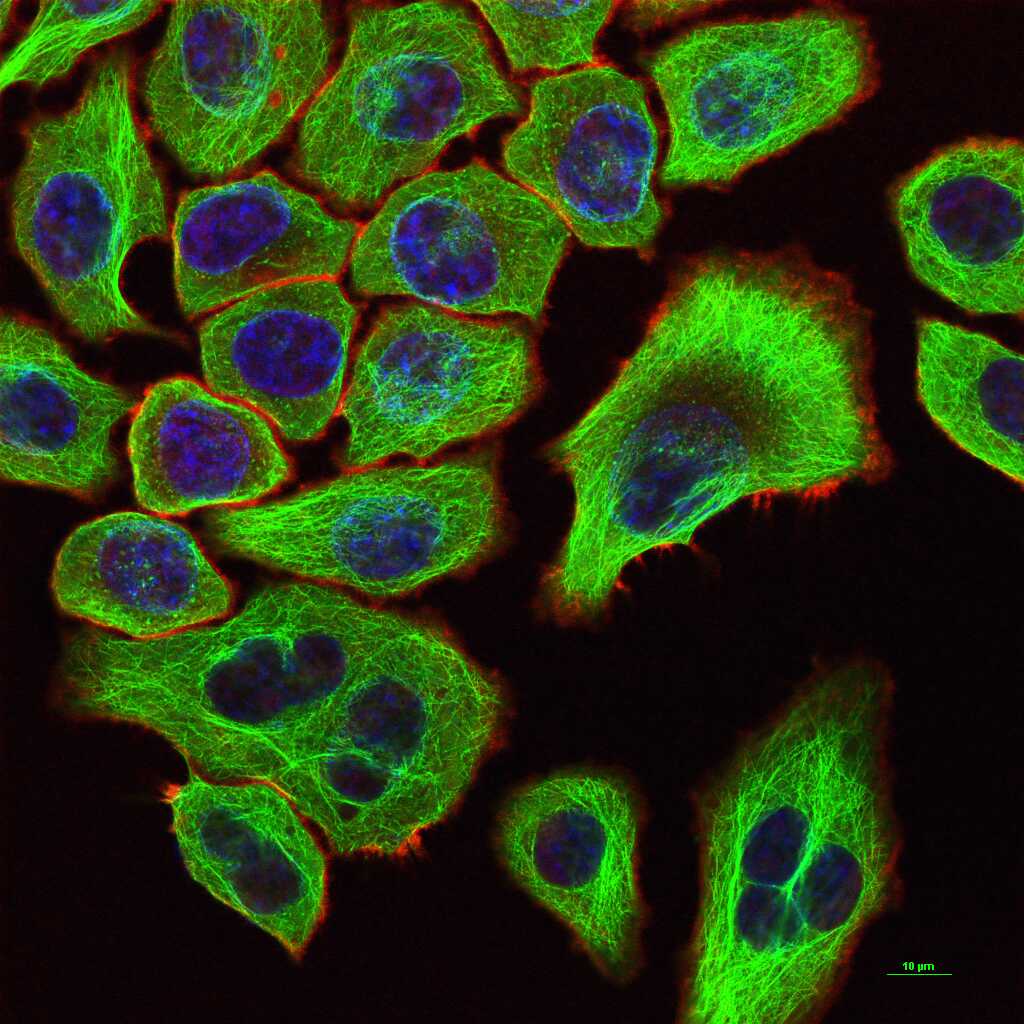微管蛋白β1 tubulin(内参)重组兔单抗-bsm-33041R