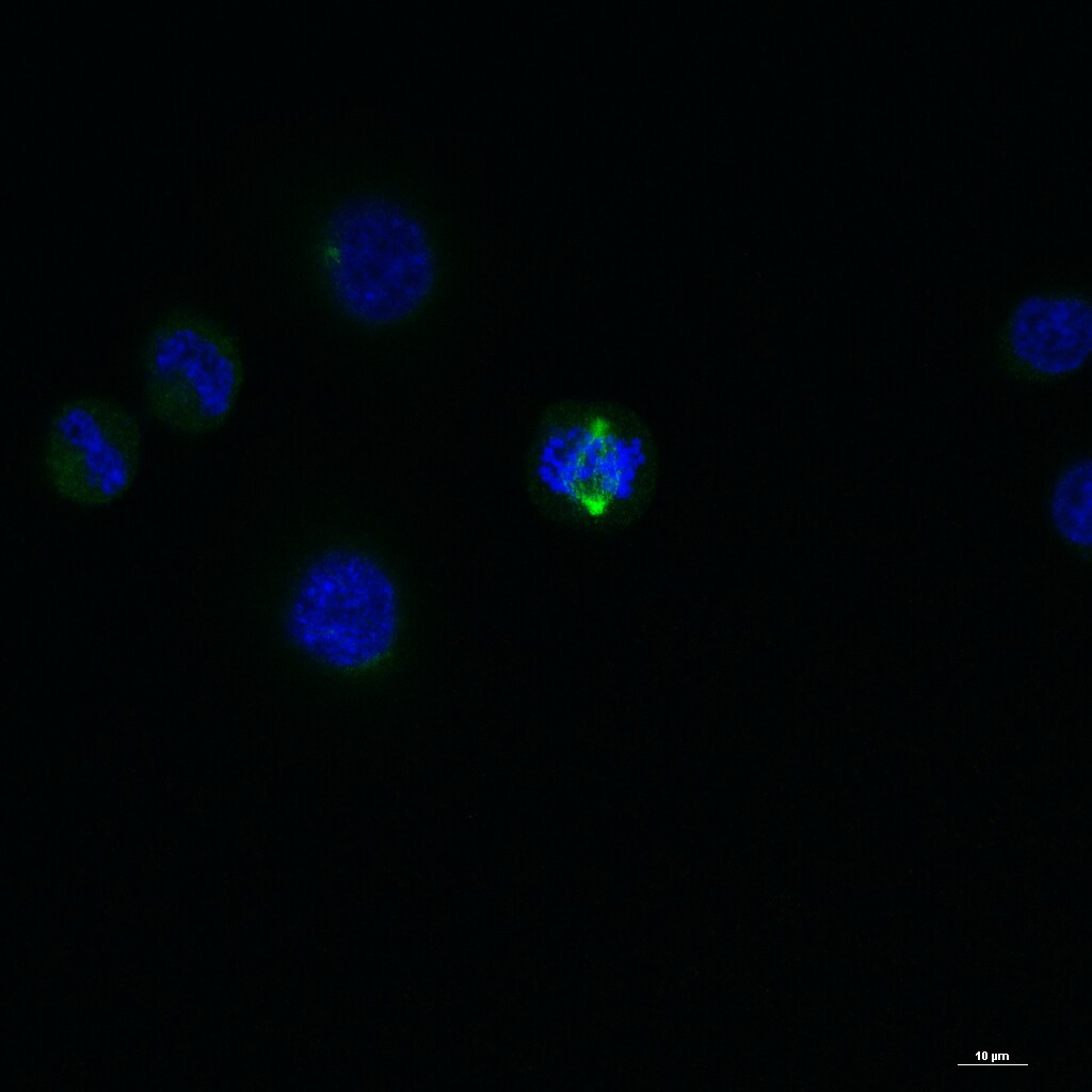TACC3重组兔单抗-bsm-61119R