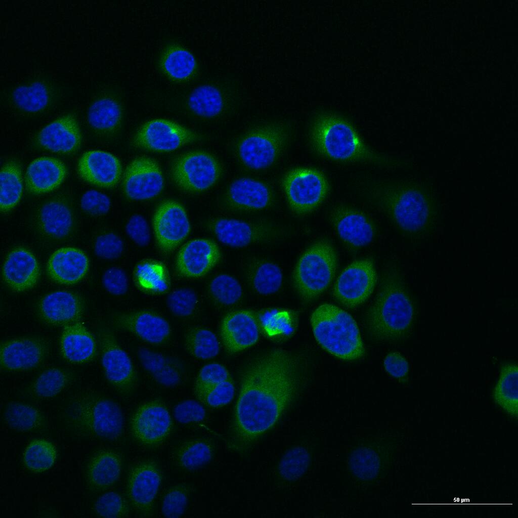 TACC3重组兔单抗-bsm-61119R