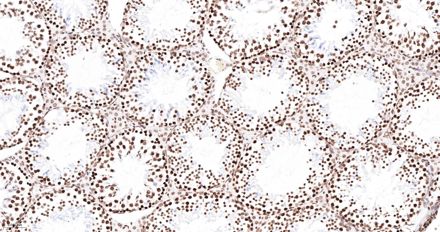 组蛋白H3重组兔单抗-bsm-60350R
