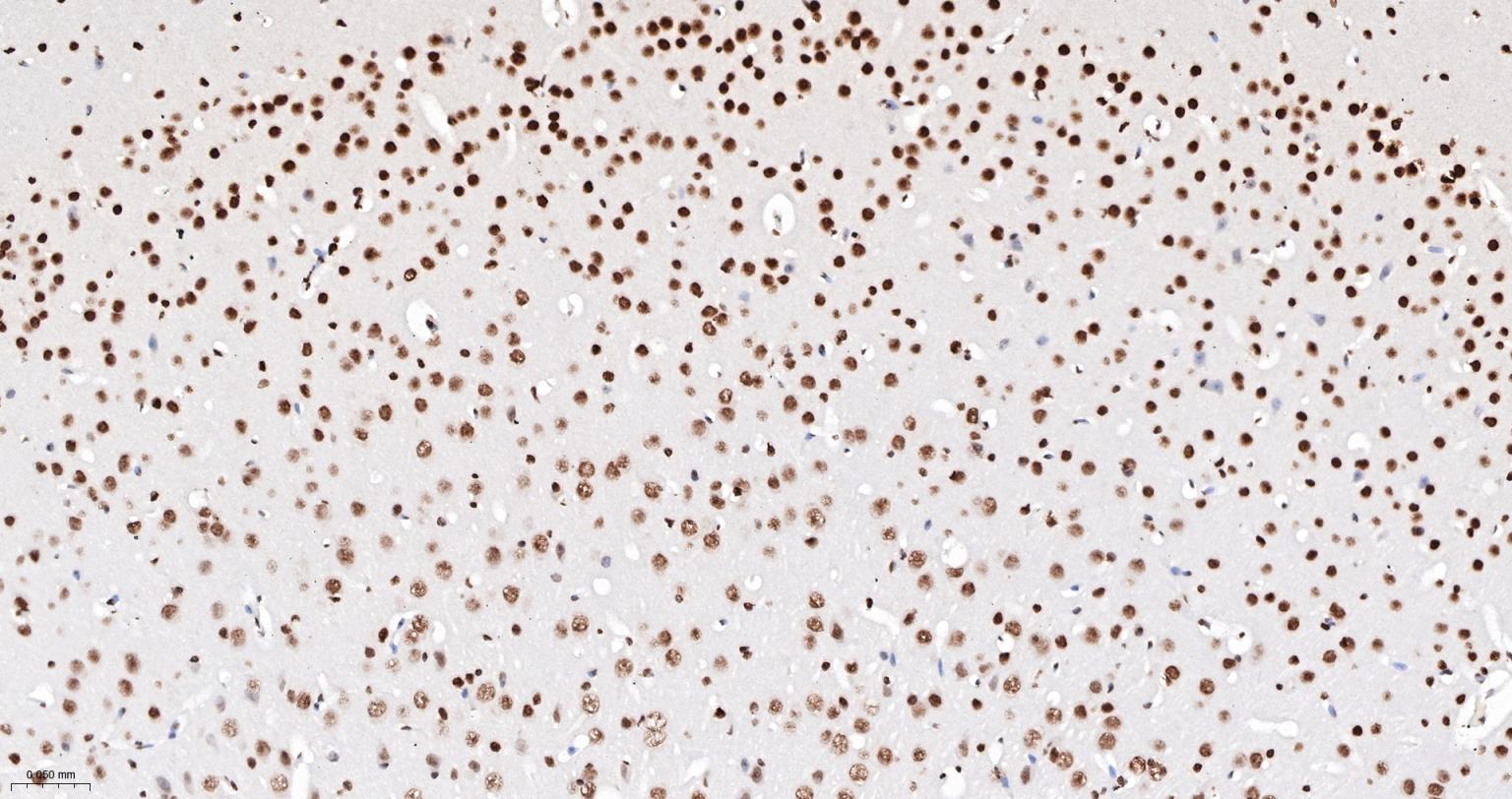 组蛋白H3重组兔单抗-bsm-60350R